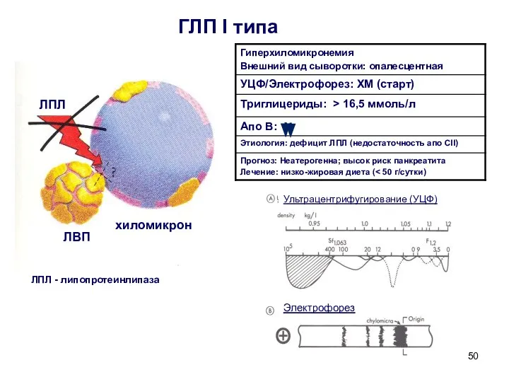 ГЛП I типа хиломикрон ЛВП ЛПЛ Электрофорез Ультрацентрифугирование (УЦФ) ЛПЛ - липопротеинлипаза