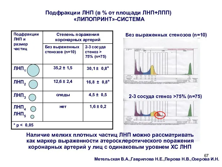 Подфракции ЛНП (в % от площади ЛНП+ЛПП) «ЛИПОПРИНТ»-СИСТЕМА Без выраженных стенозов