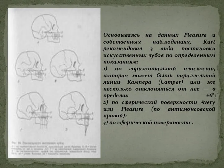 Основываясь на данных Pleasure и собственных наблюдениях, Kurt рекомендовал 3 вида