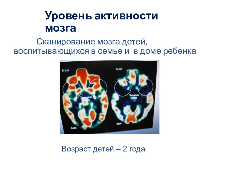 Уровень активности мозга Сканирование мозга детей, воспитывающихся в семье и в