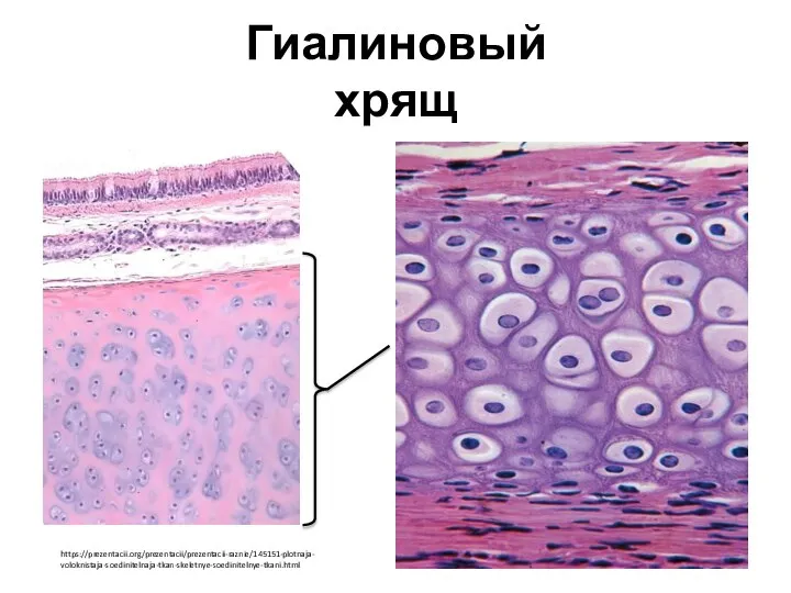 Гиалиновый хрящ https://prezentacii.org/prezentacii/prezentacii-raznie/145151-plotnaja- voloknistaja-soedinitelnaja-tkan-skeletnye-soedinitelnye-tkani.html