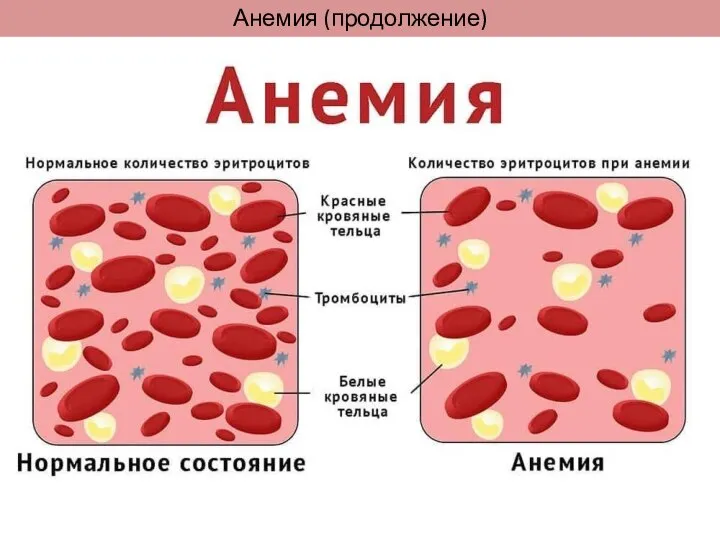 Анемия (продолжение)