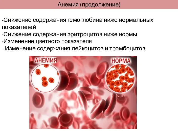 -Снижение содержания гемоглобина ниже нормальных показателей -Снижение содержания эритроцитов ниже нормы