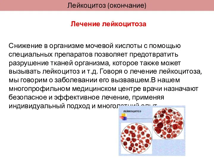 Лейкоцитоз (окончание) Снижение в организме мочевой кислоты с помощью специальных препаратов