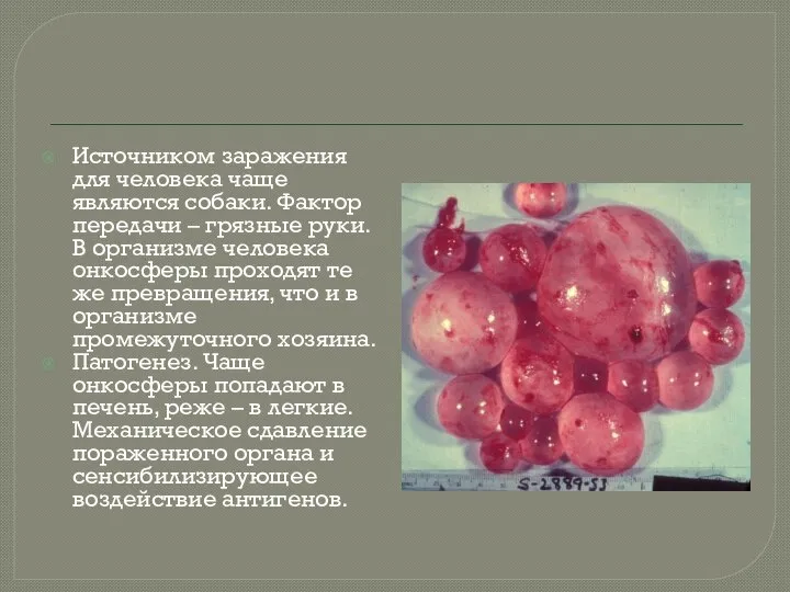 Источником заражения для человека чаще являются собаки. Фактор передачи – грязные