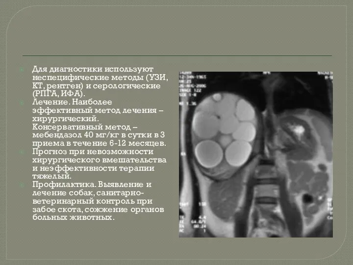 Для диагностики используют неспецифические методы (УЗИ, КТ, рентген) и серологические (РПГА,