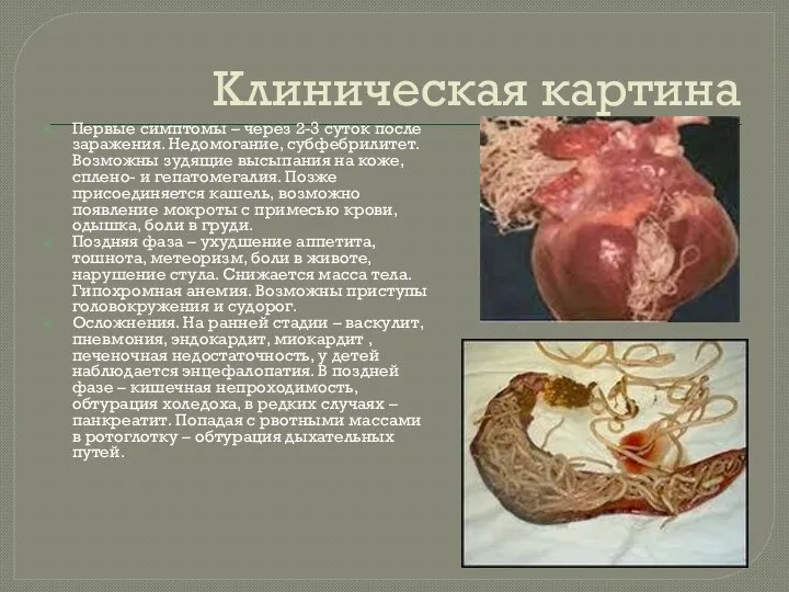 Клиническая картина Первые симптомы – через 2-3 суток после заражения. Недомогание,