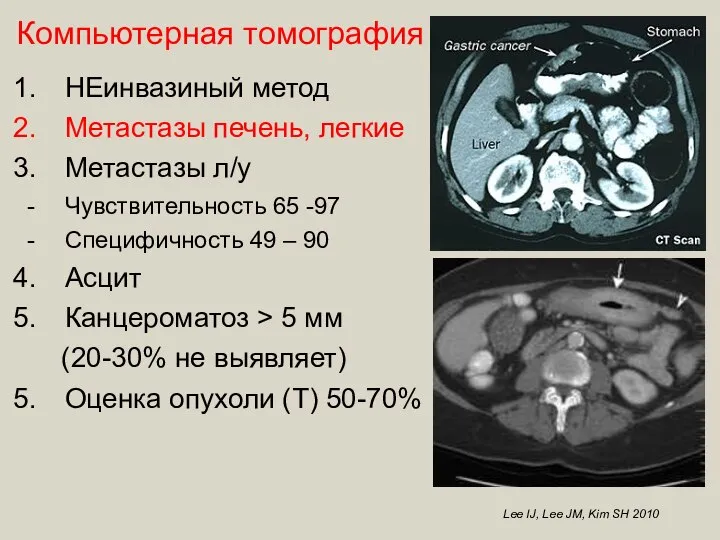 Lee IJ, Lee JM, Kim SH 2010 Компьютерная томография НЕинвазиный метод