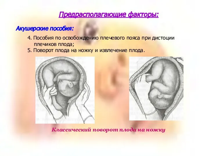 4. Пособия по освобождению плечевого пояса при дистоции плечиков плода; 5.