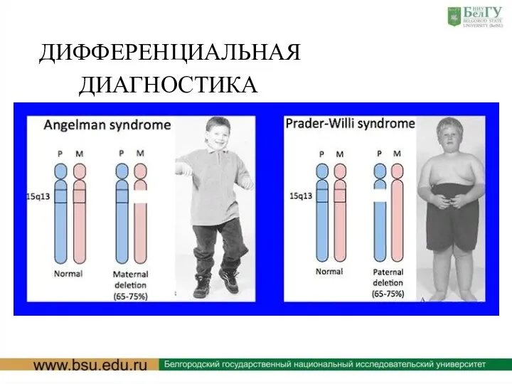 ДИФФЕРЕНЦИАЛЬНАЯ ДИАГНОСТИКА