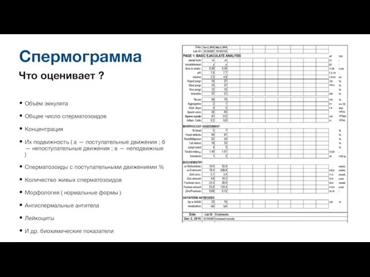 Что оценивает ? Объём эякулята Общее число сперматозоидов Концентрация Их подвижность