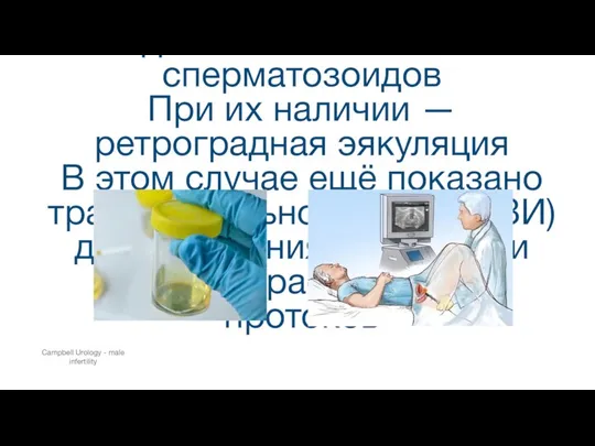 При аспермии проводят посторгазменный анализ мочи для выявления там сперматозоидов При