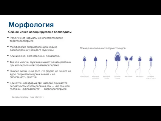 Сейчас менее ассоциируется с бесплодием Различие от нормальных сперматозоидов — тератозооспермия