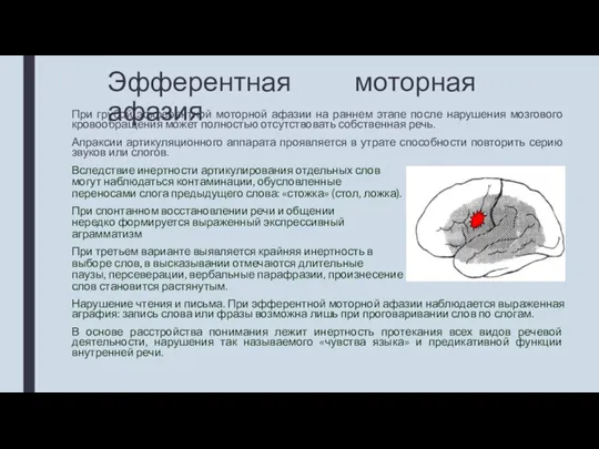 Эфферентная моторная афазия При грубой эфферентной моторной афазии на раннем этапе