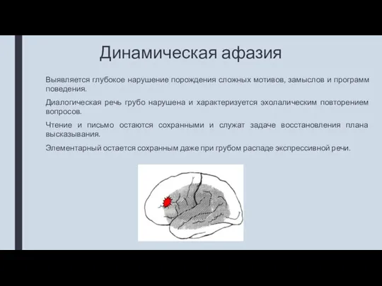 Динамическая афазия Выявляется глубокое нарушение порождения сложных мотивов, замыслов и программ