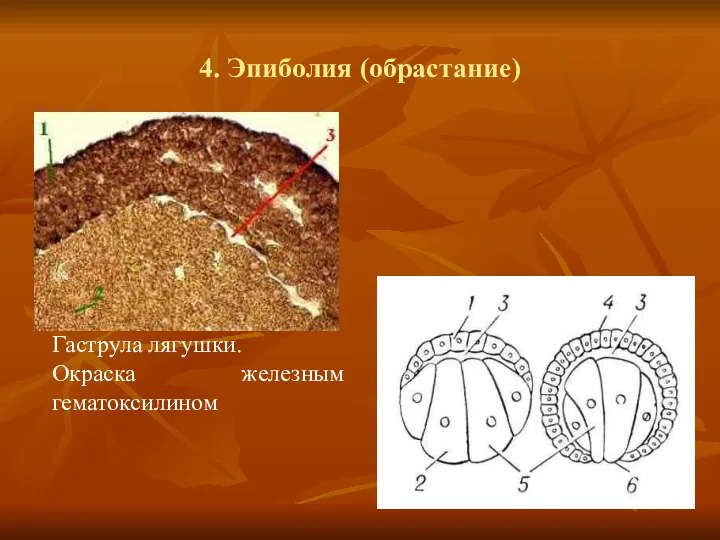 4. Эпиболия (обрастание) Гаструла лягушки. Окраска железным гематоксилином