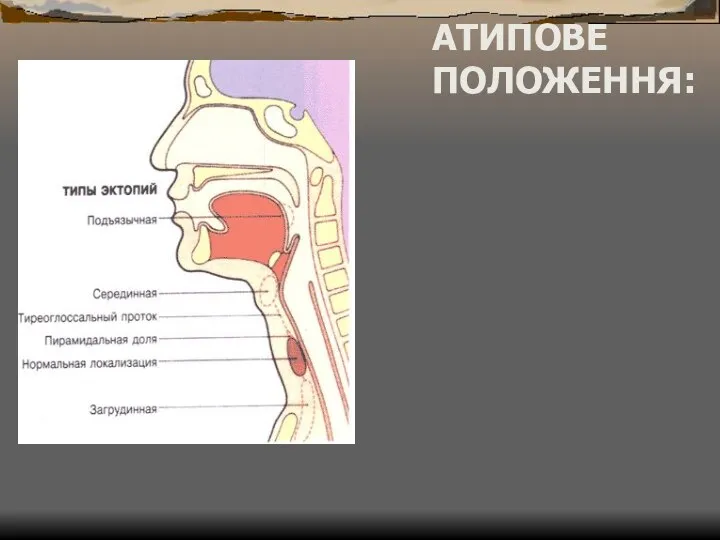 АТИПОВЕ ПОЛОЖЕННЯ: