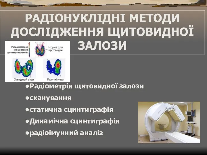 РАДІОНУКЛІДНІ МЕТОДИ ДОСЛІДЖЕННЯ ЩИТОВИДНОЇ ЗАЛОЗИ Радіометрія щитовидної залози сканування статична сцинтиграфія Динамічна сцинтиграфія радіоімунний аналіз