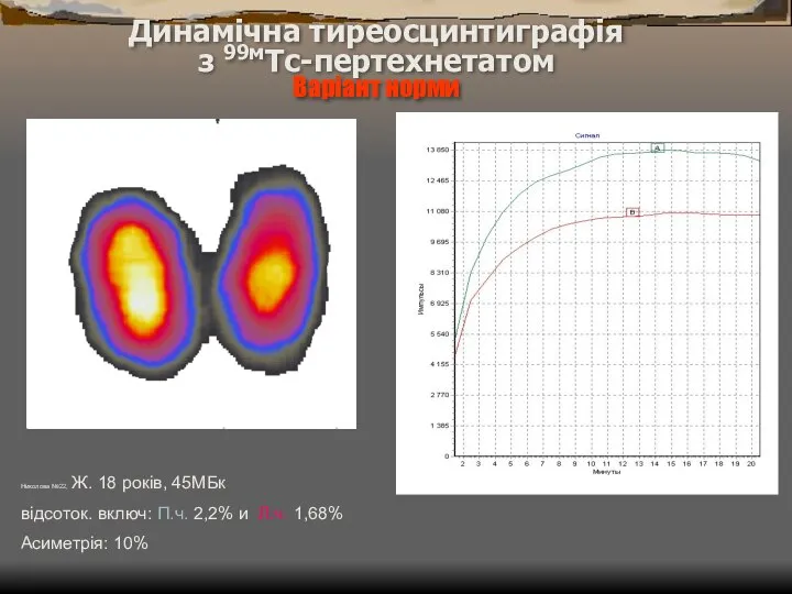 Динамічна тиреосцинтиграфія з 99мТс-пертехнетатом Варіант норми Николова №22, Ж. 18 років,