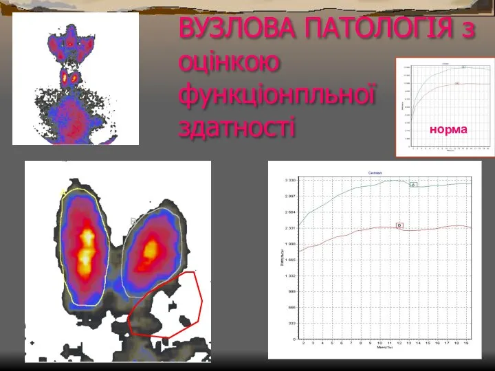 ВУЗЛОВА ПАТОЛОГІЯ з оцінкою функціонпльної здатності норма