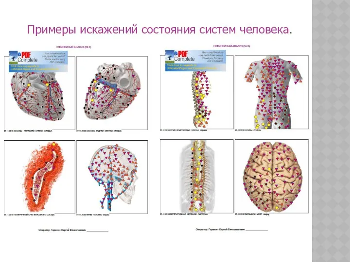 Примеры искажений состояния систем человека.