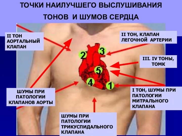 ТОЧКИ НАИЛУЧШЕГО ВЫСЛУШИВАНИЯ ТОНОВ И ШУМОВ СЕРДЦА ШУМЫ ПРИ ПАТОЛОГИИ ТРИКУСПИДАЛЬНОГО