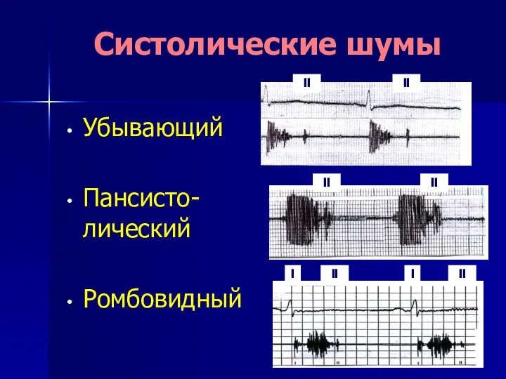 Систолические шумы Убывающий Пансисто- лический Ромбовидный II II II II II II I I