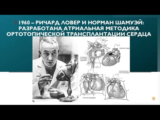 ! 1960 – РИЧАРД ЛОВЕР И НОРМАН ШАМУЭЙ: РАЗРАБОТАНА АТРИАЛЬНАЯ МЕТОДИКА ОРТОТОПИЧЕСКОЙ ТРАНСПЛАНТАЦИИ СЕРДЦА