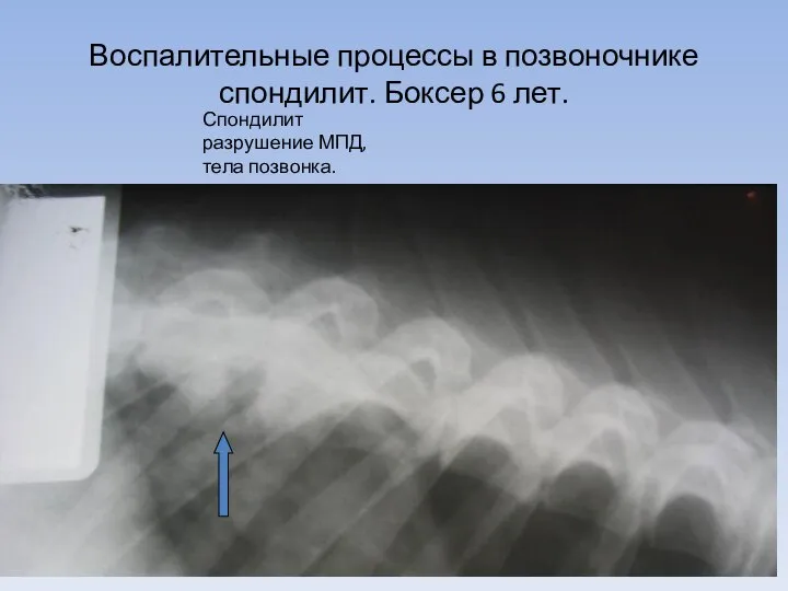 Воспалительные процессы в позвоночнике спондилит. Боксер 6 лет. Спондилит разрушение МПД, тела позвонка.