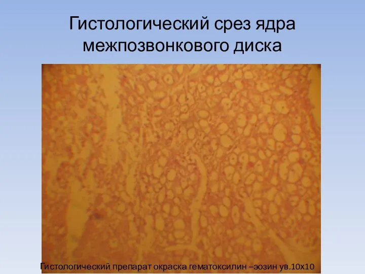 Гистологический срез ядра межпозвонкового диска Гистологический препарат окраска гематоксилин –эозин ув.10х10