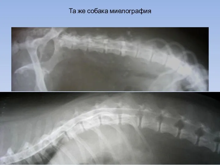 Та же собака миелография