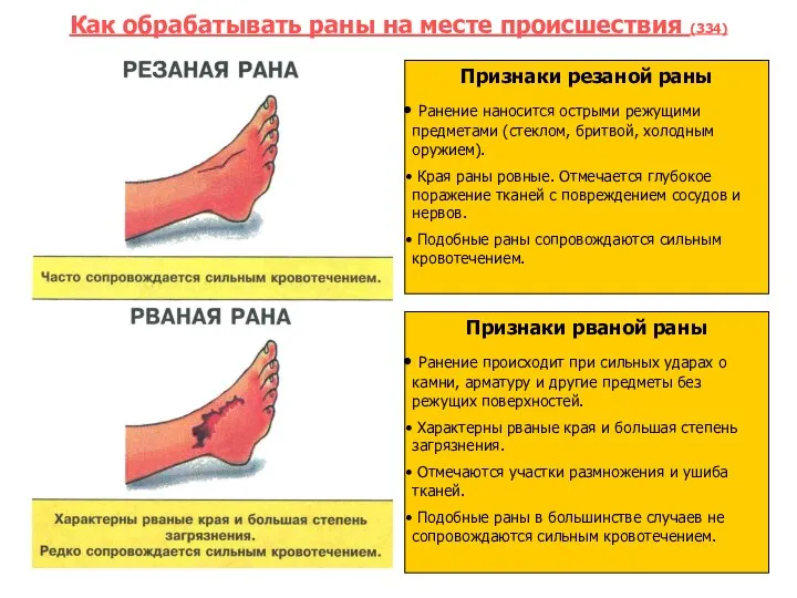 Как обрабатывать раны на месте происшествия (334) . Признаки резаной раны