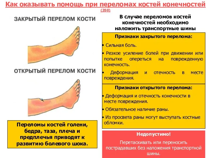 Как оказывать помощь при переломах костей конечностей (350) . В случае