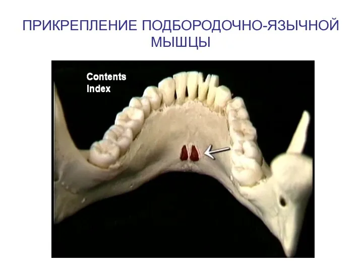 ПРИКРЕПЛЕНИЕ ПОДБОРОДОЧНО-ЯЗЫЧНОЙ МЫШЦЫ