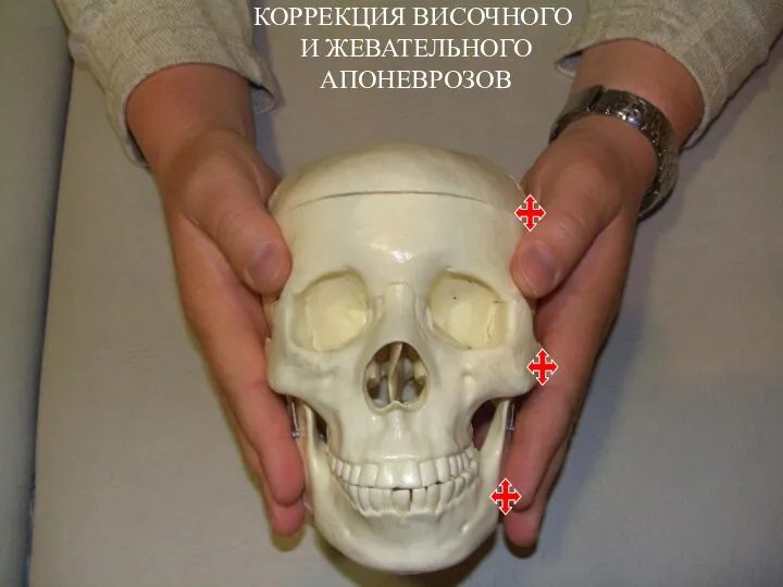 КОРРЕКЦИЯ ВИСОЧНОГО И ЖЕВАТЕЛЬНОГО АПОНЕВРОЗОВ