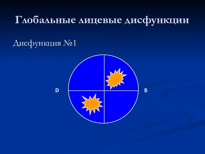 Глобальные лицевые дисфункции Дисфункция №1 D S