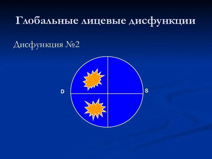 Глобальные лицевые дисфункции Дисфункция №2 D S