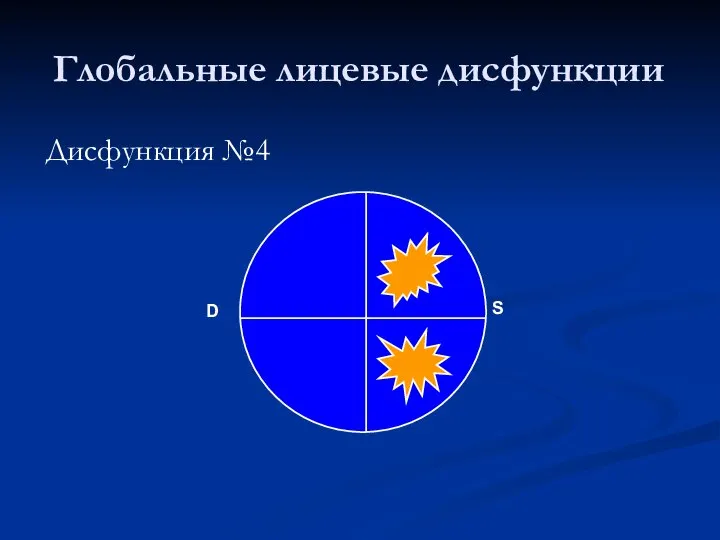 Глобальные лицевые дисфункции Дисфункция №4 D S