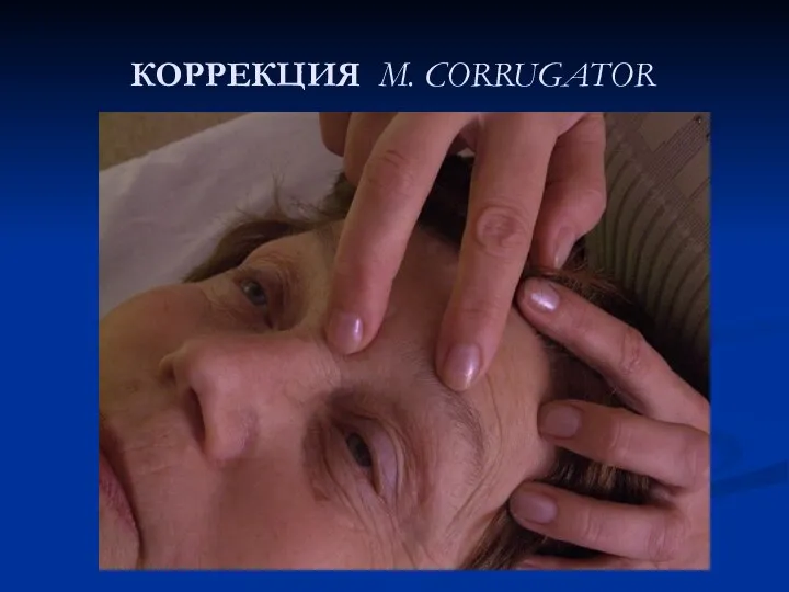 КОРРЕКЦИЯ M. CORRUGATOR