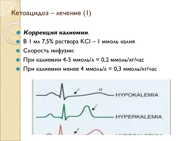 Кетоацидоз – лечение (1) Коррекция калиемии. В 1 мл 7,5% раствора