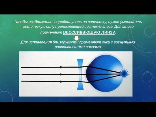 Чтобы изображение передвинулось на сетчатку, нужно уменьшить оптическую силу преломляющей системы