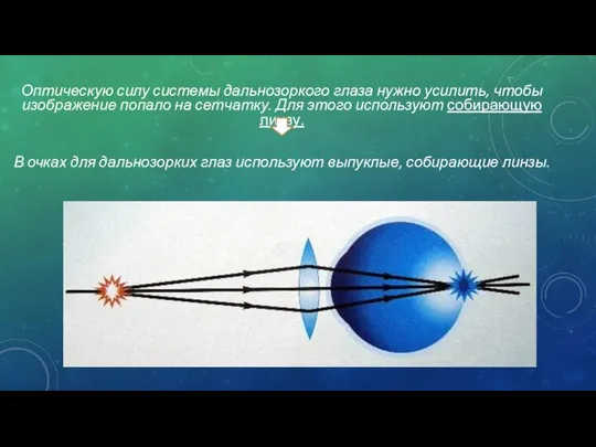 Оптическую силу системы дальнозоркого глаза нужно усилить, чтобы изображение попало на