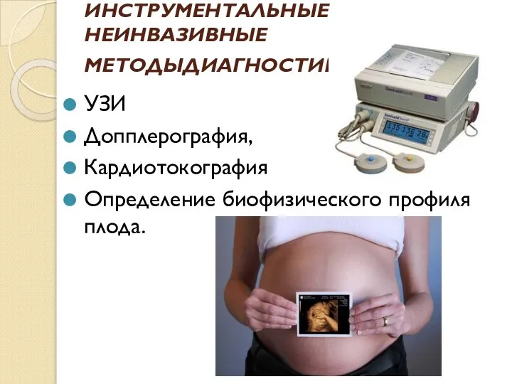 ИНСТРУМЕНТАЛЬНЫЕ НЕИНВАЗИВНЫЕ МЕТОДЫДИАГНОСТИКИ: УЗИ Допплерография, Кардиотокография Определение биофизического профиля плода.