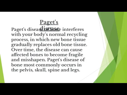 Paget's disease Paget's disease of bone interferes with your body's normal