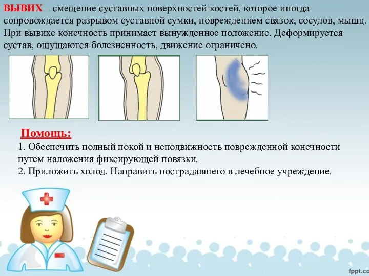 ВЫВИХ – смещение суставных поверхностей костей, которое иногда сопровождается разрывом суставной