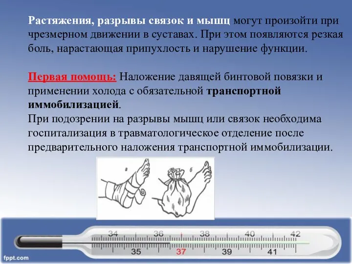 Растяжения, разрывы связок и мышц могут произойти при чрезмерном движении в