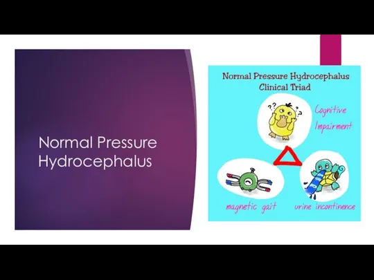 Normal Pressure Hydrocephalus