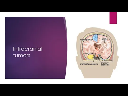 Intracranial tumors