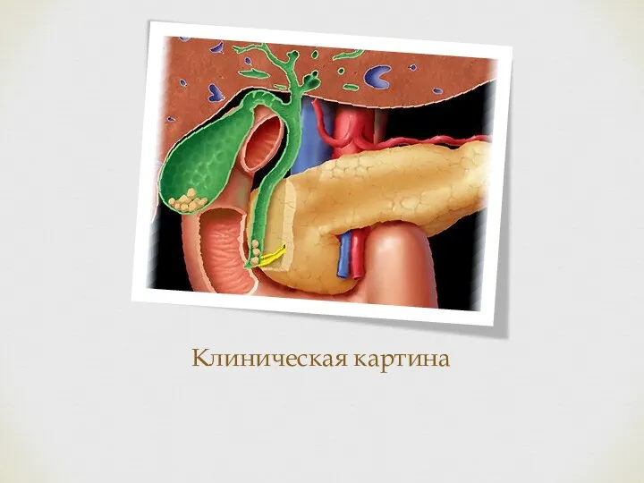 Клиническая картина