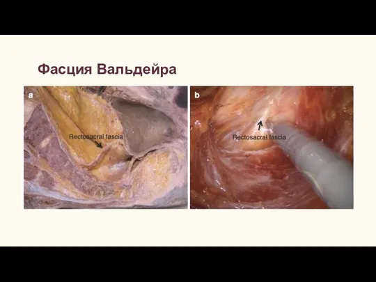 Фасция Вальдейра